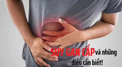 Suy gan cấp và những điều cần biết để tránh gặp nguy hiểm